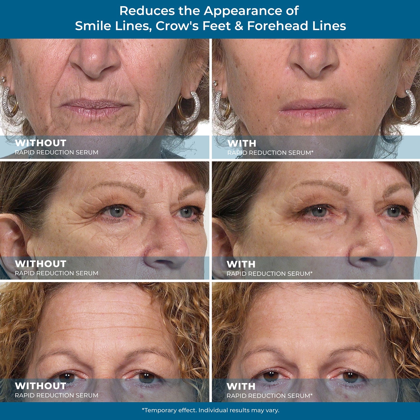 Rapid Reduction Serum –10ml- 1-Month Supply